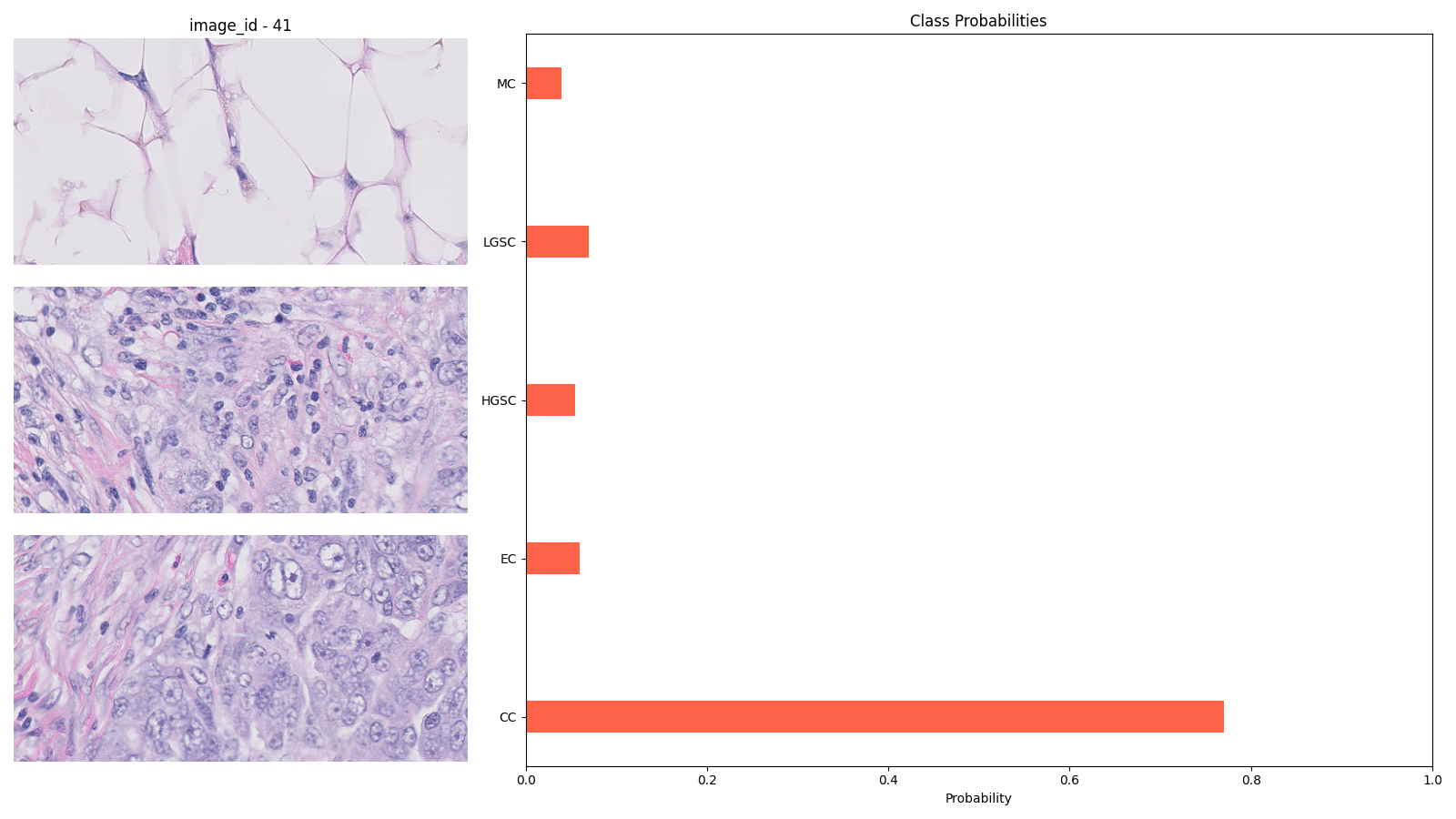 biopsy sample images and predictions